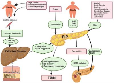 Fatty infiltration of the pancreas: a systematic concept analysis